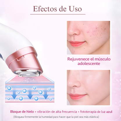 Lifting Pro™ - Rejuvenecedor de Mirada